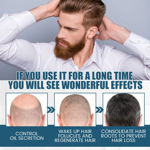 Hair Serum Hair Growth Serum Premature Greying Oil Serum Hair Oil - GreGone - 1 - GreGone