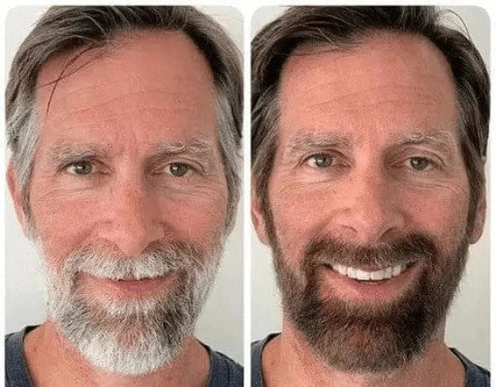 Hair Serum Hair Growth Serum Premature Greying Oil Serum Hair Oil - GreGone - 1 - GreGone