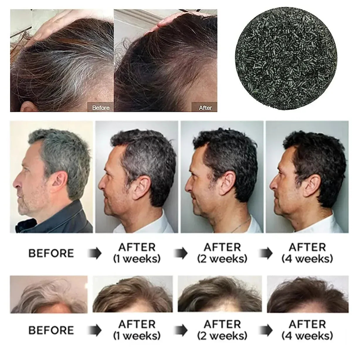 Hair Serum Hair Growth Serum Premature Greying Oil Serum Hair Oil - GreGone - 1 - GreGone