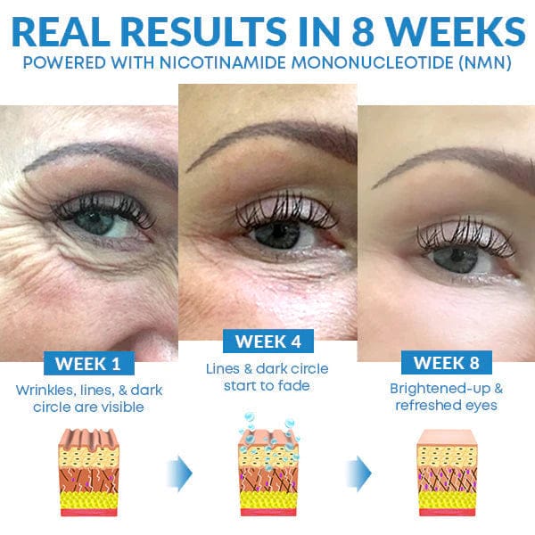 Anti ageing and Dark circle serum Anti ageing and Dark circle serum